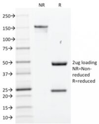 Data from SDS-PAGE analysis of Anti-SOX2 antibody (Clone SOX2/1791). Reducing lane (R) shows heavy and light chain fragments. NR lane shows intact antibody with expected MW of approximately 150 kDa. The data are consistent with a high purity, intact mAb.